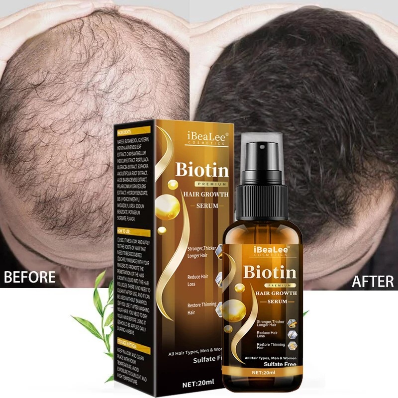 Hair care solution, strong hai - Roots Nutrition & Fitness Inglewood Photos incelemesi ve fiyatı