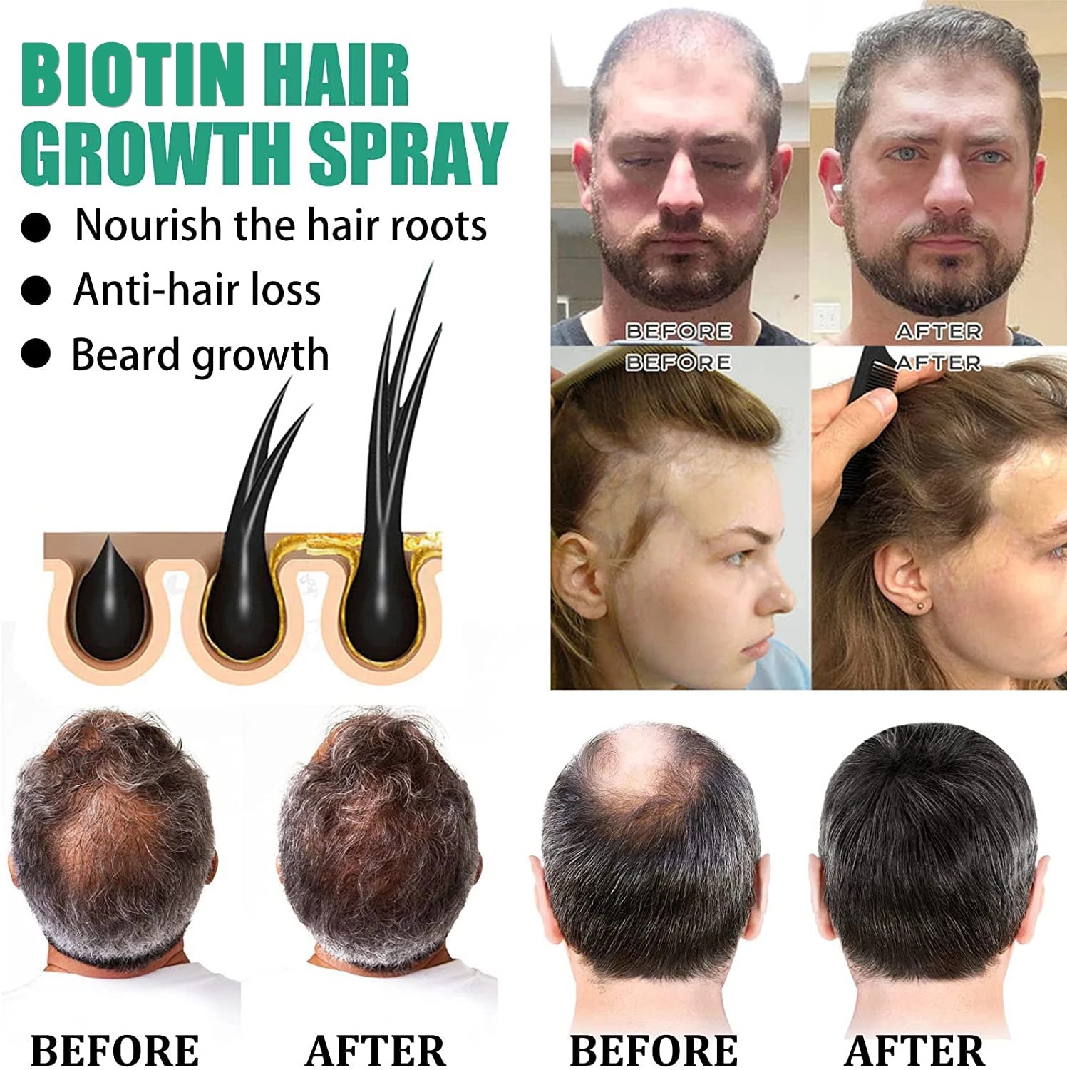 Hair care solution, strong hai - Roots Nutrition & Fitness Inglewood Photos incelemesi ve fiyatı