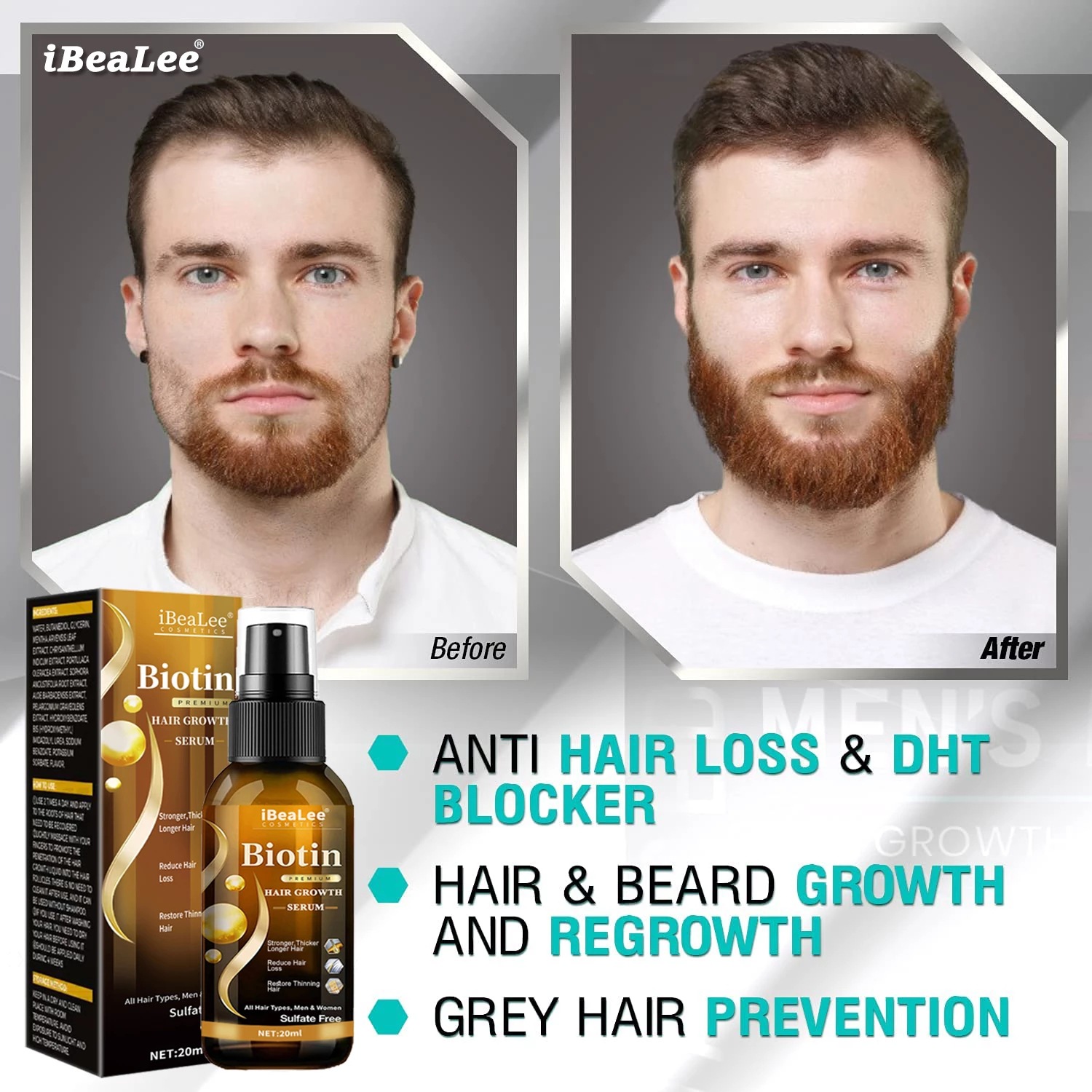 Hair care solution, strong hai - Roots Nutrition & Fitness Inglewood Photos incelemesi ve fiyatı