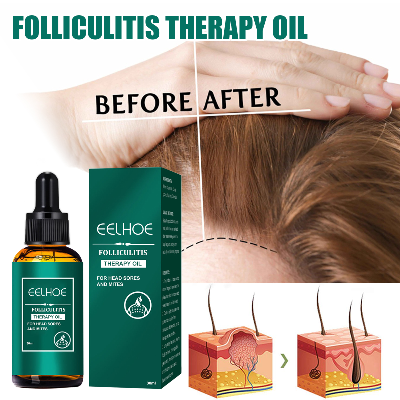 Scalp Treatment Serum Follicle - Roots Nutrition & Fitness Inglewood Photos incelemesi ve fiyatı