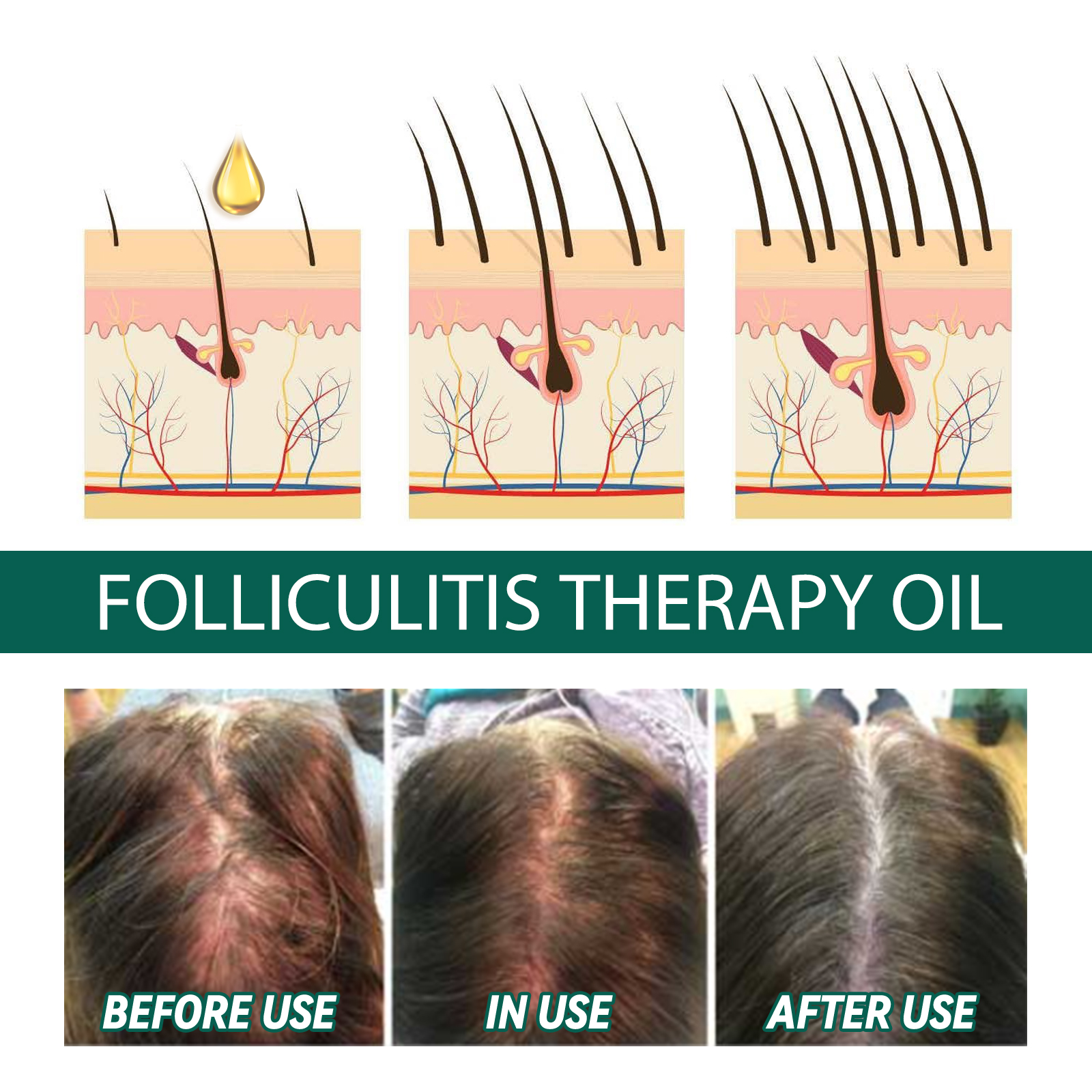 Scalp Treatment Serum Follicle - Roots Nutrition & Fitness Inglewood Photos incelemesi ve fiyatı
